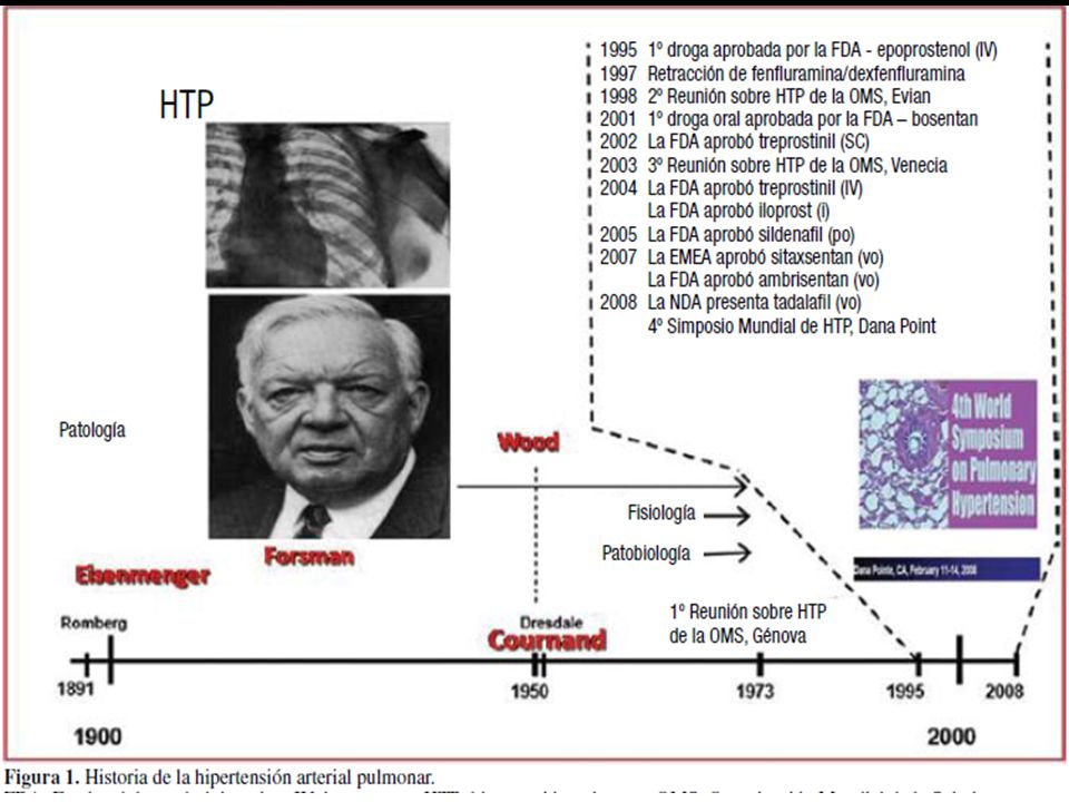 Quien clase 2 hipertensión pulmonar
